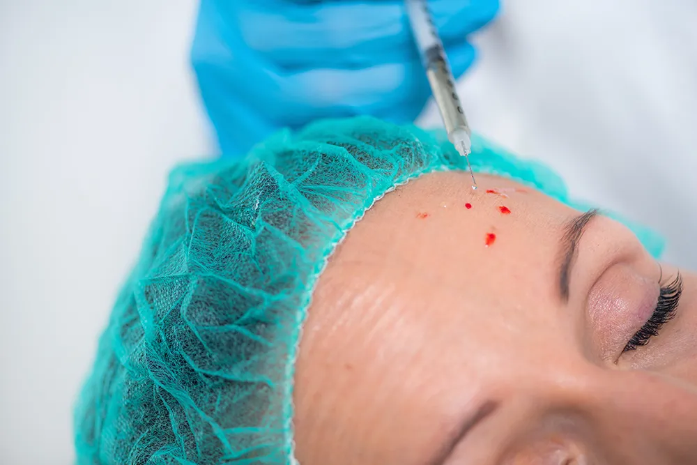 Understanding Platelet-Rich Plasma (PRP) Therapy: A Natural Approach to Healing in Metro Atlanta, Georgia